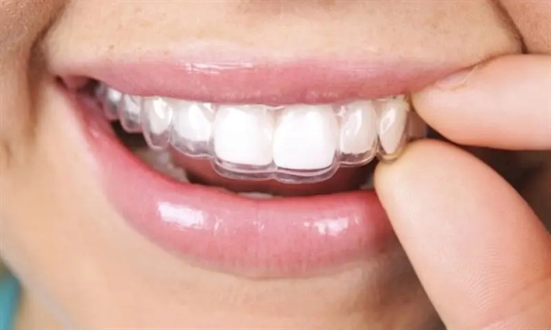 ortodontik tedavi
